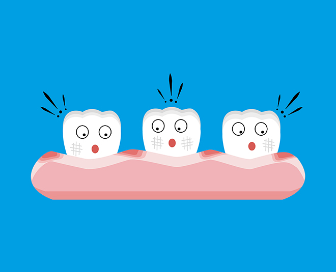 Gums से ब्लड आना gums bleed